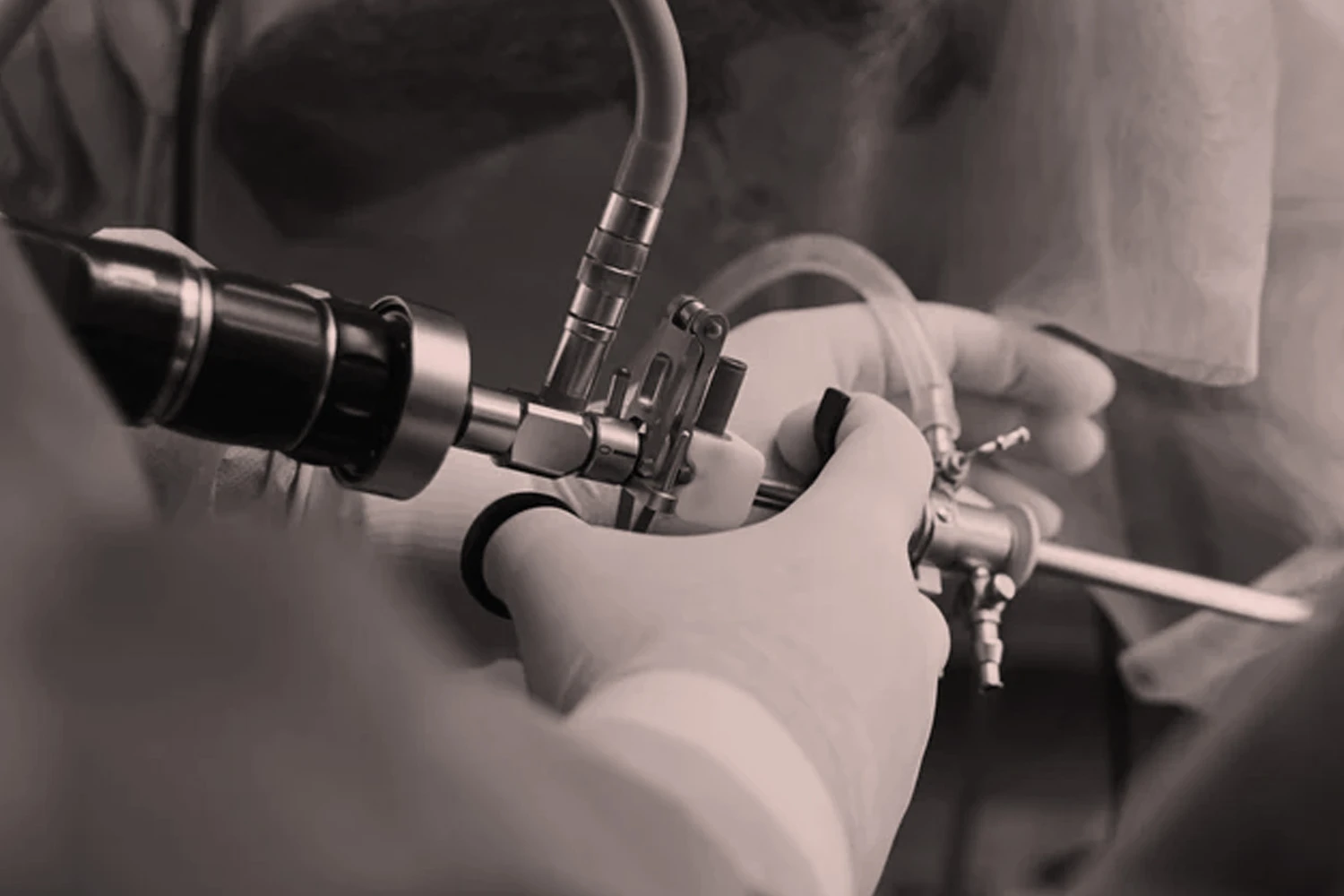 Endourological Procedures performed by Dr. Jeena KR